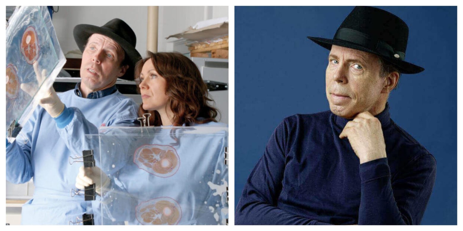 Gunther von Hagens Là Ai? Bí Mật Công Nghệ Plastination "Bất Tử Hóa" Xác Người